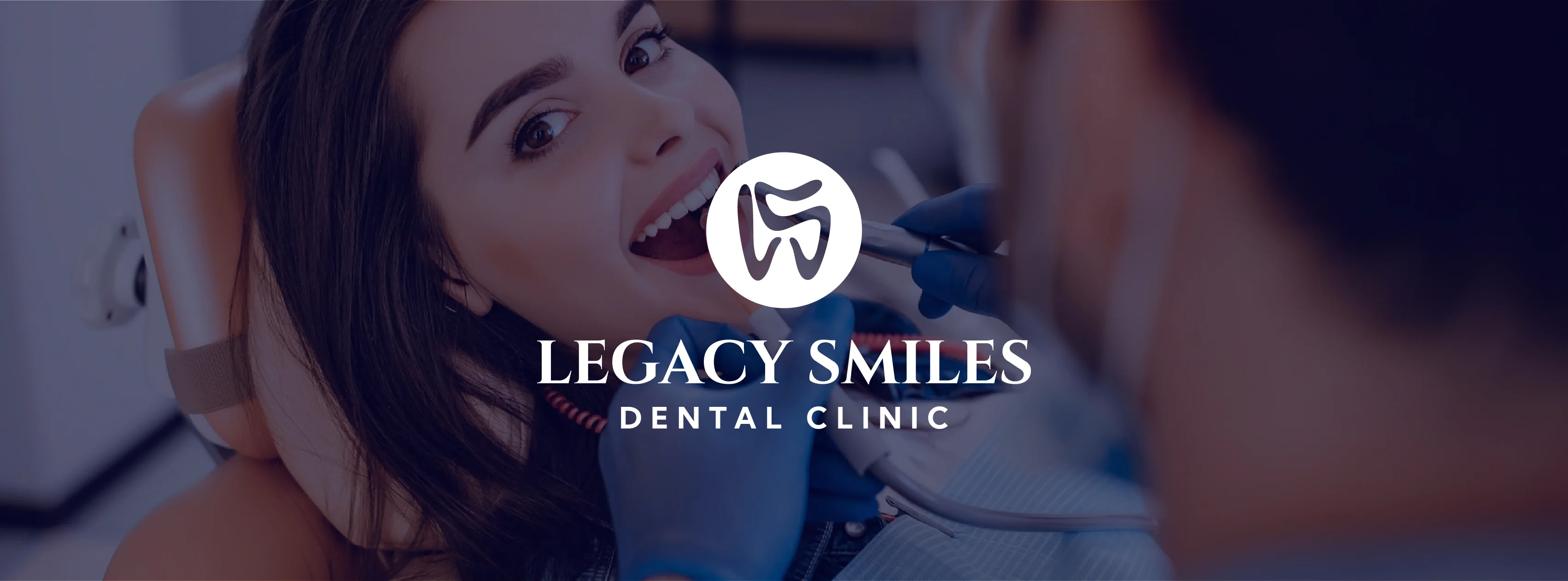 Fixed Bridge E Fixed Dental Bridge in Cebu: Cost, Zirconia Crowns, and Treatment for ...